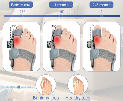 Premium Bunion Corrector Brace ™Letshome Wellness